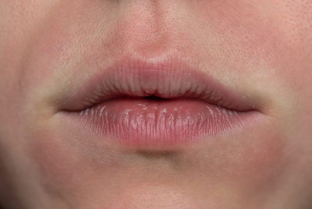 Understanding What Sunburned Lips Look Like and Feel Like